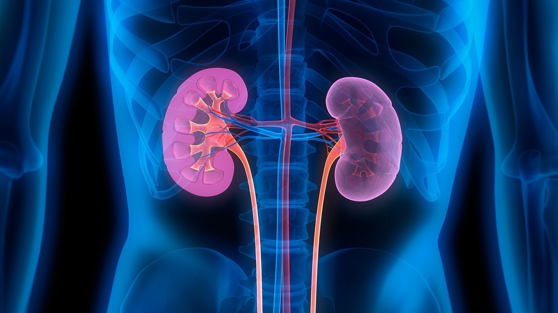 Managing Chronic Kidney Disease